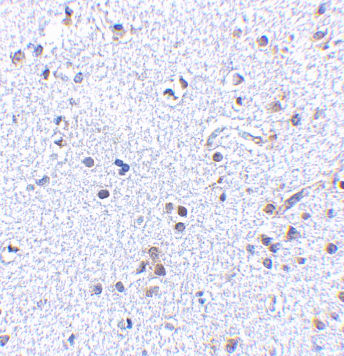 Immunohistochemistry: TSLP Antibody - BSA Free [NB110-55233] - Figure 3 Immunohistochemistry Validation of TSLP in Human Brain Tissue  Immunohistochemical analysis of paraffin-embedded Human Brain Tissue using anti-TSLP antibody  at 2.5 u/ml. Tissue was fixed with formaldehyde and blocked with 10% serum for 1 h at RT; antigen retrieval was by heat mediation with a citrate buffer (pH6). Samples were incubated with primary antibody overnight at 4C. A goat anti-rabbit IgG H&L (HRP) at 1/250 was used as secondary. Counter stained with Hematoxylin.