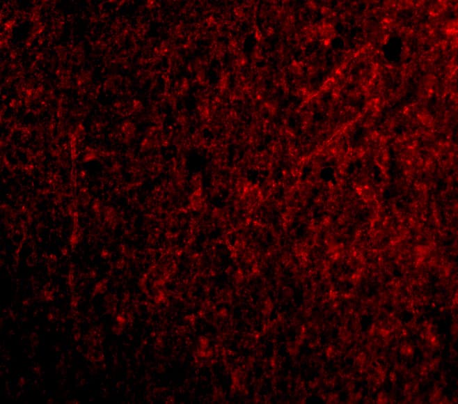 Immunocytochemistry/ Immunofluorescence: TSLP Antibody - BSA Free [NB110-55234] - Figure 4 Immunofluorescence Validation of TSLP in Human Brain TissueImmunofluorescent analysis of 4% paraformaldehyde-fixed Human Brain Tissue labeling TSLP with  at 20 u/mL, followed by goat anti-rabbit IgG secondary antibody at 1/500 dilution (red).  