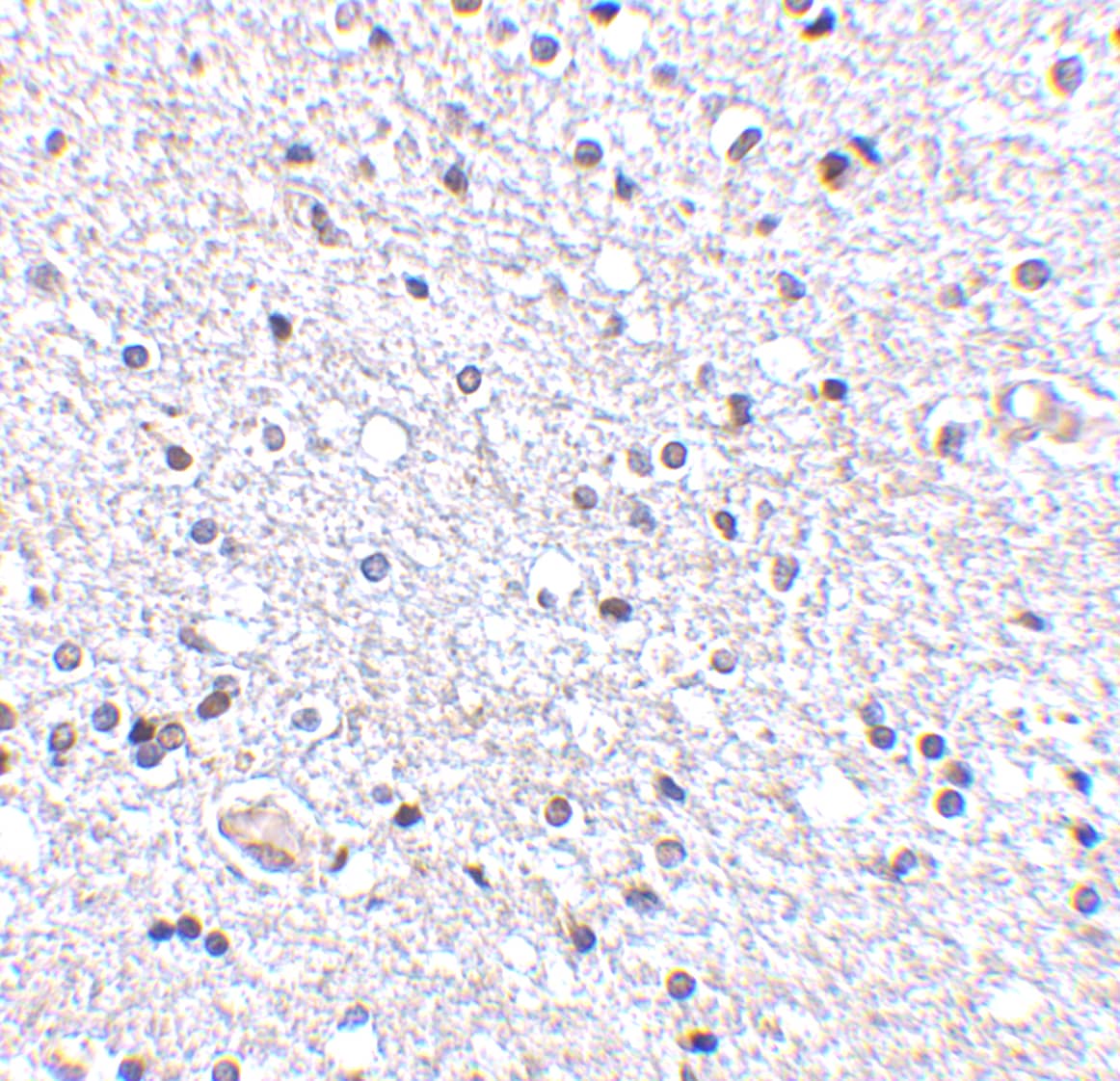 Immunohistochemistry: TSLP Antibody - BSA Free [NB110-55234] - Figure 5 Immunohistochemistry Validation of TSLP in Human Brain Tissue  Immunohistochemical analysis of paraffin-embedded Human Brain Tissue using anti-TSLP antibody  at 2.5 u/ml. Tissue was fixed with formaldehyde and blocked with 10% serum for 1 h at RT; antigen retrieval was by heat mediation with a citrate buffer (pH6). Samples were incubated with primary antibody overnight at 4C. A goat anti-rabbit IgG H&L (HRP) at 1/250 was used as secondary. Counter stained with Hematoxylin.