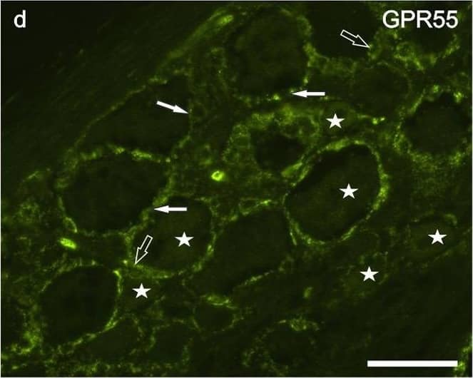 Immunocytochemistry/ Immunofluorescence: GPR55 Antibody - BSA Free [NB110-55498] - Photomicrographs of cryosections of canine cervical (C8) dorsal root ganglion showing GPR55 (a–f) & PPARalpha (g–i) immunolabeling. (a–c) Arrows indicate the Neurotrace-labeled nuclei of satellite glial cells (a) which showed bright GPR55 immunolabelling (b). White stars indicate unlabeled sensory neurons; open stars indicate empty spaces in which sensory neurons were no more evident. (d–f) White arrows indicate satellite glial cells which co-expressed bright GPR55- (d) & glial fibrillary acidic protein (GFAP) immunoreactivity; open arrows indicate SGCs which were GPR55 immunoreactive & GFAP negative (e). Stars indicate sensory neurons of different dimension, which expressed faint –to-moderate GPR55 immunoreactivity. (g–i) White arrows indicate the Neurotrace labeled nuclei of SGCs which showed PPARalpha immunoreactivity (h). Open arrow indicate autofluorescent pigment. Bar: a–i = 50 μm. Image collected & cropped by CiteAb from the following publication (//pubmed.ncbi.nlm.nih.gov/31608295), licensed under a CC-BY license. Not internally tested by Novus Biologicals.