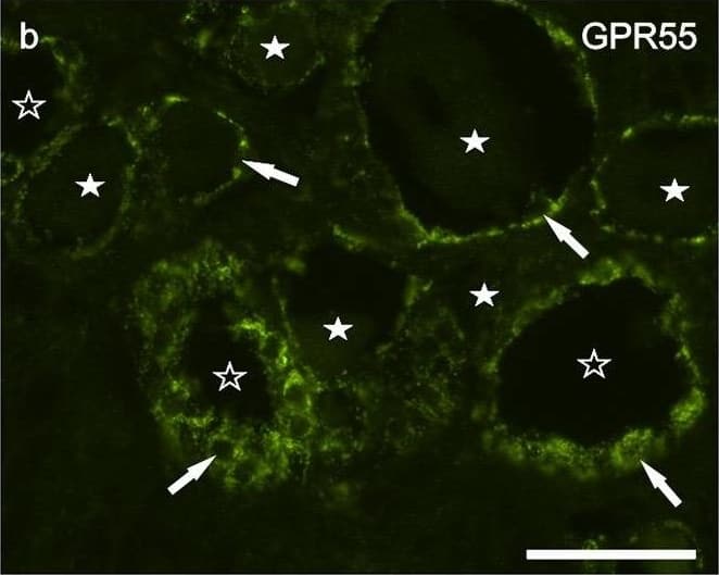 Immunocytochemistry/ Immunofluorescence: GPR55 Antibody - BSA Free [NB110-55498] - Photomicrographs of cryosections of canine cervical (C8) dorsal root ganglion showing GPR55 (a–f) & PPARalpha (g–i) immunolabeling. (a–c) Arrows indicate the Neurotrace-labeled nuclei of satellite glial cells (a) which showed bright GPR55 immunolabelling (b). White stars indicate unlabeled sensory neurons; open stars indicate empty spaces in which sensory neurons were no more evident. (d–f) White arrows indicate satellite glial cells which co-expressed bright GPR55- (d) & glial fibrillary acidic protein (GFAP) immunoreactivity; open arrows indicate SGCs which were GPR55 immunoreactive & GFAP negative (e). Stars indicate sensory neurons of different dimension, which expressed faint –to-moderate GPR55 immunoreactivity. (g–i) White arrows indicate the Neurotrace labeled nuclei of SGCs which showed PPARalpha immunoreactivity (h). Open arrow indicate autofluorescent pigment. Bar: a–i = 50 μm. Image collected & cropped by CiteAb from the following publication (//pubmed.ncbi.nlm.nih.gov/31608295), licensed under a CC-BY license. Not internally tested by Novus Biologicals.