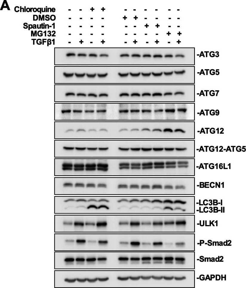 Western Blot: ATG9A Antibody - BSA Free [NB110-56893] - The effect of chloroquine, spautin-1 & MG132 on ATG protein levels in A549 cells. (A) A549 cells were treated with 50 μM chloroquine, 10 μM spautin-1 or 5 μM MG132 in the presence or absence of 250 pM TGF beta 1 for 24 h. Cells were lysed & subjected to SDS-PAGE & immunoblotting anti-ATG3, anti-ATG5, anti-ATG7, anti-ATG9, anti-ATG12, anti-ATG12-ATG5 complex, anti-ATG16L1, anti-BECN1, anti-ULK1, anti-LC3B, anti-P-Smad2, anti-Smad2 & anti-GAPDH (loading control) antibodies. (B) The steady state levels of ATG3, ATG5, ATG7, ATG9, ATG12, ATG12-ATG5, ATG16L1, BECN1, ULK1, & LC3B were quantitated using QuantityOne software & graphed (n=3, mean±s.e.m.). Significance is indicated as *=P<0.05, **P<0.01 & ****=P<0.0001. Image collected & cropped by CiteAb from the following publication (//pubmed.ncbi.nlm.nih.gov/33168592), licensed under a CC-BY license. Not internally tested by Novus Biologicals.