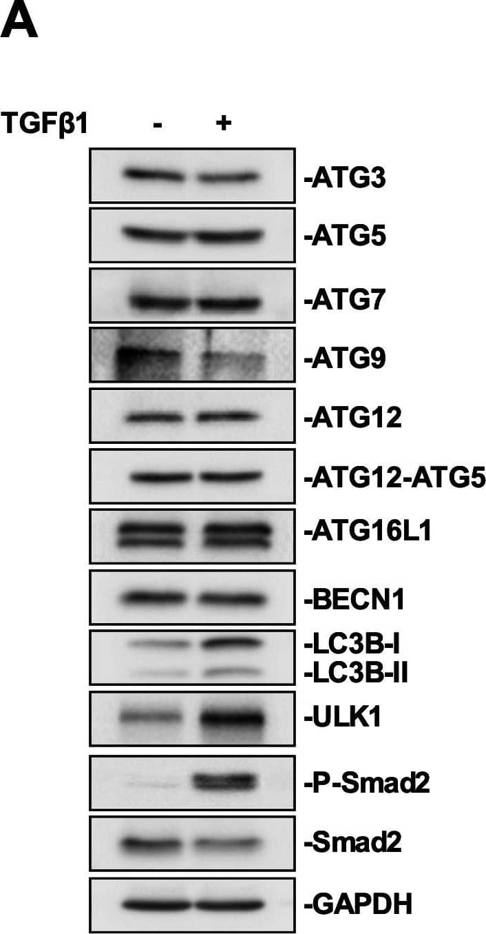 Western Blot: ATG9A Antibody - BSA Free [NB110-56893] - The effect of TGF beta 1 on ATG protein levels & LC3B lipidation in A549 cells. (A) A549 cells were treated with 250 pM TGF beta 1 for 24 h. Cells were lysed & subjected to SDS-PAGE & immunoblotting anti-ATG3, anti-ATG5, anti-ATG7, anti-ATG9, anti-ATG12, anti-ATG12-ATG5 complex, anti-ATG16L1, anti-BECN1, anti-ULK1, anti-LC3B, anti-P-Smad2, anti-Smad2 & anti-GAPDH (loading control) antibodies. (B) The steady state levels of ATG3, ATG5, ATG7, ATG9, ATG12, ATG12-ATG5, ATG16L1, BECN1, ULK1, & LC3B were quantitated using QuantityOne software & graphed (n=3±s.e.m.). Significance is indicated as *=P<0.05, **P<0.01 & ****=P<0.0001. Image collected & cropped by CiteAb from the following publication (//pubmed.ncbi.nlm.nih.gov/33168592), licensed under a CC-BY license. Not internally tested by Novus Biologicals.