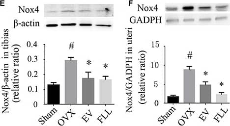 Western Blot: Nox4 Antibody - BSA Free [NB110-58849] - The representative images of immunohistochemical staining (A–D; sections were counterstained with hematoxylin; original magnification, × 20), & western blot assays (E,F) showed that FLL treatment decreased Nox4 expression in tibias & uteri of OVX rats (n = 9). In addition, FLL treatment also decreased cytochrome C (Cyto-C; G) & increased Bcl-2 expression (H) in the tibias of OVX rats (n = 9). Data are presented as mean ± SD. IOD denotes integrated optical density of interested areas. #p < 0.05 with Sham group, *p < 0.05 compared with OVX group. Image collected & cropped by CiteAb from the following publication (//pubmed.ncbi.nlm.nih.gov/28588482), licensed under a CC-BY license. Not internally tested by Novus Biologicals.