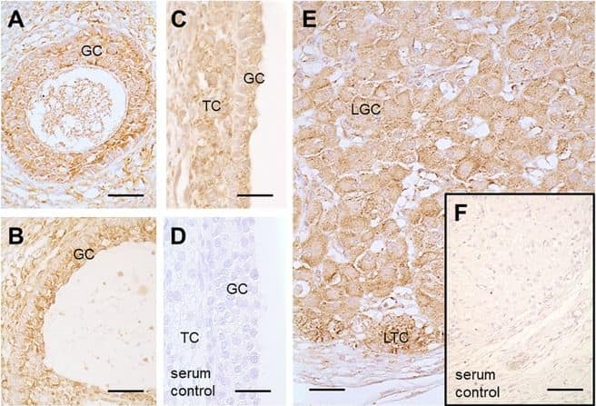 Immunohistochemistry: Nox4 Antibody - BSA Free [NB110-58849] - Presence of NOX4 in human ovarian tissue. Immunohistochemistry using human ovarian sections & an anti-NOX4 antibody from ProSci showed positive staining for NOX4 in granulosa (GC) & theca cells (TC) of a secondary follicle (A), of a small antral follicle (B), of a large antral follicle (C) as well as in luteinized GCs (LGC) & luteinized TCs (LTC) of the corpus luteum (E). Serum controls lacked first antibody (D & F). Scale bars: A–E = 30 µm, F = 50 µm. Image collected & cropped by CiteAb from the following publication (//pubmed.ncbi.nlm.nih.gov/30837663), licensed under a CC-BY license. Not internally tested by Novus Biologicals.