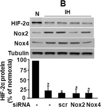 Immunohistochemistry: Nox4 Antibody - BSA Free [NB110-58849] - AT1-KO mice are resistant to alcohol-induced oxidative stress. Oxidative stress was examined by immunohistochemical staining of  NOX4 (D) expression was examined by immunohistochemical staining. Data are presented as means +/- SD. *, P 0.05. Image collected & cropped by CiteAb from the following publication (//pubmed.ncbi.nlm.nih.gov/24124516), licensed under a CC-BY license. Not internally tested by Novus Biologicals.