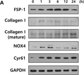 Western Blot: Nox4 Antibody - BSA Free [NB110-58849] - Fbs stimulated by BMM differentiate into myofibroblasts via the Cyr61/Nox4 pathway. (A) Western blotting for Fb differentiation, involving analysis of specific factors such as FSP-1, NOX2, NOX4, collagen-1, & Cyr61. The expression of these factors was normalized to that of GAPDH; (B) Cells were treated with BMM for 3 or 6 h or DPI (5 μM; NOX inhibitor) for 1 h or were co-treated with DPI & BMM. ROS production was measured using the DCF-DA assay & calculated as a percentage of the mean fluorescence intensity compared with that of the control. * p < 0.05 as compared to the control; # p < 0.05 as compared to the BMM (6 h)-treated group; (C) Cells were treated with BMM for 3 h or DPI (5 μM, NOX inhibitor) for 1 h or were co-treated with DPI & BMM. Cyr61 expression was normalized to that of GAPDH after western blotting. The values indicate intensities of protein expression with respect to that of the loading control; (D) Secretion of MMPs from BMM-treated-Fbs by using conditioned medium, followed by western blotting analysis. The expression levels were normalized to PonceauS, used as a loading control. *** p < 0.001 as compared to the control. Image collected & cropped by CiteAb from the following publication (//www.mdpi.com/1422-0067/19/4/1164), licensed under a CC-BY license. Not internally tested by Novus Biologicals.