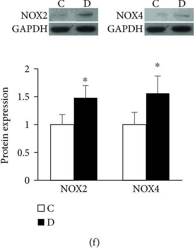 Western Blot: Nox4 Antibody - BSA Free [NB110-58849] - Diabetic atrophied muscles exhibited a state of heightened oxidative stress (HSOS). (a & b) Superoxide generation was measured in frozen muscle sections of control & diabetic using dihydroethidium-based confocal microscopic staining technique. (c & d) NADPH oxidase in a membrane fraction was assessed according to procedure involving the substrate NADPH & lucigenin chemiluminescence or the Amplex Red/horseradish peroxidase fluorescence-based assays. (e & f) Muscle NADPH oxidase-related isoforms including NOX2 & NOX4 were determined at the mRNA (e) & protein levels (f) using RT-PCR & Western blotting-based techniques. (g) Mitochondrial H2O2 generation at the steady state level & in the presence of added glutamate/malate substrates was measured using the Amplex Red/horseradish peroxidase fluorescence-based assay (g). Activities of complexes I (h) & III (i) of the electron transport chain were measured using spectrophotometric-based assay. Abbreviation: C: control; D: diabetic. Values are means ± SEM for at least 6 animals/group. ∗Significantly different from corresponding control values at P ≤ 0.05. Image collected & cropped by CiteAb from the following publication (//pubmed.ncbi.nlm.nih.gov/30510624), licensed under a CC-BY license. Not internally tested by Novus Biologicals.