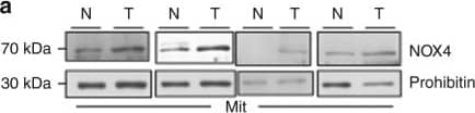 Western Blot: Nox4 Antibody - BSA Free [NB110-58849] - Characterization of NOX4 & PKM2 in human RCC tumors & adjacent tissue. a Mitochondrial fractions were prepared from human tumors (T) or uninvolved adjacent tissue (N). NOX4 expression was examined by western blot analysis. Prohibitin was probed as a mitochondrial marker & loading control. b Quantitation of NOX4 distribution in the mitochondrial fraction from a. The results are expressed as the means using one-way ANOVA with Tukey’s post hoc test where ± S.E.M. *p < 0.05 compared to normal (N). c Mitochondria fractions were prepared from RCC tumors & NADPH-dependent superoxide generation was examined in the presence (+) or absence (−) of ATP. The results are from eight tumors & are expressed as the means using one-way ANOVA with Tukey’s post hoc test where ±S.E.M. **p < 0.01 is compared to without (−) ATP. d PKM2 & PKM1 expression was examined by western blot analysis in lysates prepared from human tumors (T) or uninvolved adjacent tissue (N) from the same patient. Actin as loading control Image collected & cropped by CiteAb from the following publication (//pubmed.ncbi.nlm.nih.gov/29051480), licensed under a CC-BY license. Not internally tested by Novus Biologicals.