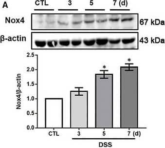 Western Blot: Nox4 Antibody - BSA Free [NB110-58849] - DSC ameliorates Nox4 expression & ROS production. A, Colitis was induced as described in Materials & Methods, & the colonic tissues were collected as indicated periods. Representative bands & quantitative analysis of Nox4 in colonic tissues were shown. B‐F, Colitis was induced as described in Materials & Methods & treated with or without DSC (50 mg/kg). B, Representative bands & quantitative analysis of Nox4 in colonic tissues. C, Representative images & quantitative analysis of ROS production by DHE staining in colonic tissues, scale bar = 100 μm. D, Quantitative analysis of GSH/GSSG ratio. E, Quantitative analysis of tissue H2O2 production. Colitis was induced as described in Materials & Methods & treated with or lentiviral Nox4 shRNA. F, Representative bands & quantitative analysis of Nox4 in colonic tissues. G, Representative images & quantitative analysis of colon length. H, Representative images of H&E staining & histological score. I, Representative bands & quantitative analysis of ZO‐2 & claudin‐1 expression in colonic tissues.  beta ‐actin was used as loading control. Data shown are means ± SEM of n = 8 in each group. *P < 0.05 vs Control (CTL), #P < 0.05 vs DSS‐treated mice Image collected & cropped by CiteAb from the following publication (//pubmed.ncbi.nlm.nih.gov/32945118), licensed under a CC-BY license. Not internally tested by Novus Biologicals.