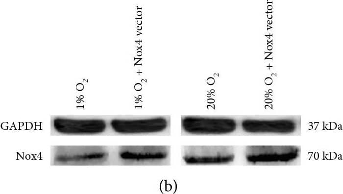 Western Blot: Nox4 Antibody - BSA Free [NB110-58851] - Nox4 overexpression boosted ROS production & induced DNA damage in NP cells. (a) RT-qPCR analysis (N = 4) of Nox4, MsrB1, & MsrB2 in NP cells overexpressing Nox4. (b) Representative immunoblot analysis of Nox4 in NP cells overexpressing Nox4. (c) ROS production in NP cells overexpressing Nox4 (N = 3). (d, e) Immunofluorescence staining of  gamma -H2A.X & percentage of  gamma -H2A.X-positive cells in NP cells overexpressing Nox4 (N = 8). NP cells were transfected with Nox4 vectors for Nox4 overexpression. ∗, P value < 0.05, error bars represent standard error. Image collected & cropped by CiteAb from the following publication (//pubmed.ncbi.nlm.nih.gov/29147462), licensed under a CC-BY license. Not internally tested by Novus Biologicals.