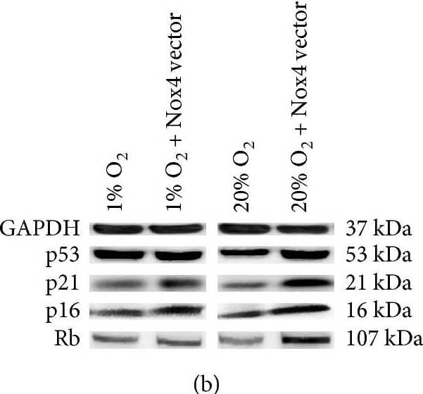 Western Blot: Nox4 Antibody - BSA Free [NB110-58851] - Nox4 overexpression accelerated senescence of NP cells. (a, b) RT-qPCR analysis (N = 4) & representative immunoblot analysis of p53, p16, p21, & Rb in NP cells overexpressing Nox4. (c) The percentage of SA-beta -gal-positive NP cells overexpressing Nox4 (N = 8). (d, e) Immunofluorescence staining of BrdU & percentage of BrdU-positive cells in NP cells overexpressing Nox4 (N = 8). (f, g) RT-qPCR analysis of matrix degradation enzymes & proinflammatory cytokines in NP cells overexpressing Nox4 (N = 4). NP cells were transfected with Nox4 vectors for Nox4 overexpression. ∗, P value < 0.05, error bars represent standard error. Image collected & cropped by CiteAb from the following publication (//pubmed.ncbi.nlm.nih.gov/29147462), licensed under a CC-BY license. Not internally tested by Novus Biologicals.