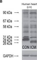 Western Blot: Nox4 Antibody - BSA Free [NB110-58851] - Alternative splicing of NOX4 in rat kidney & heart (A). Alternative splicing of NOX4 in human hearts (B). Quantitative evaluation of spliced NOX4 isoforms in ICM samples (C). Quantitative evaluation of spliced NOX4 isoforms in DCM samples (D). Data are mean ± S.E.M. n = 5/group. *p < 0.05. LV, left ventricle; IVS, interventricular septum; RV, right ventricle; ICM, ischemic cardiomyopathy; DCM, dilated cardiomyopathy. Image collected & cropped by CiteAb from the following publication (//pubmed.ncbi.nlm.nih.gov/29204124), licensed under a CC-BY license. Not internally tested by Novus Biologicals.