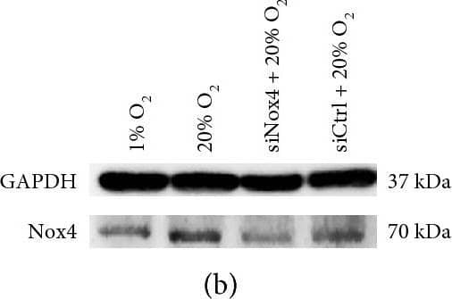 Western Blot: Nox4 Antibody - BSA Free [NB110-58851] - Small interfering RNA against Nox4 (siNox4) alleviated oxidative stress & DNA damage induced by high oxygen tension in NP cells. (a, b) RT-qPCR analysis (N = 3) & representative immunoblot analysis of Nox4 in NP cells. The knockdown of Nox4 in NP cells was confirmed. (c) ROS production in NP cells (N = 3). (d) RT-qPCR analysis of MsrbA, MsrB1, & MsrB2 in NP cells (N = 3). (e, f) Immunofluorescence staining of  gamma -H2A.X & percentage of  gamma -H2A.X-positive cells in NP cells (N = 6). NP cells were transfected with siNox4 or scrambled siRNA control (siCtrl) before high oxygen tension treatment. ∗, P value < 0.05, error bars represent standard error. Image collected & cropped by CiteAb from the following publication (//pubmed.ncbi.nlm.nih.gov/29147462), licensed under a CC-BY license. Not internally tested by Novus Biologicals.