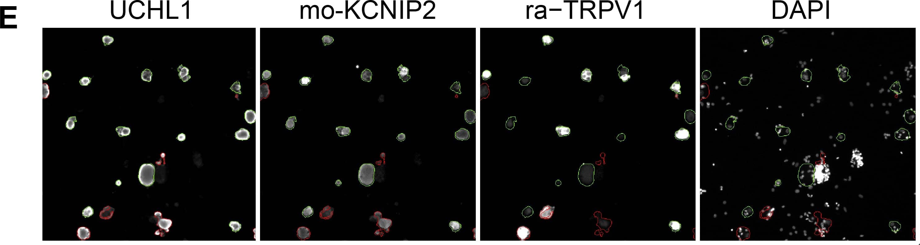 Immunocytochemistry/ Immunofluorescence: UCH-L1/PGP9.5 Antibody [NB110-58872] - Validation of the transcriptome data by single cell based quantitative High Content Screening (HCS) microscopy focusing on selected signaling-relevant proteins.(A) Triple staining of the neuronal marker UCHL1 & two different TRPV1 antibodies derived from rabbit & goat, respectively, to facilitate the analysis of various targets. The staining intensities obtained with both TRPV1 antibodies correlated significantly (Spearmans ρ = 0.96, p3000 analyzed neurons per experiment, paired two-tailed t-tests). Image collected & cropped by CiteAb from the following publication (//dx.plos.org/10.1371/journal.pone.0115731), licensed under a CC-BY license. Not internally tested by Novus Biologicals.