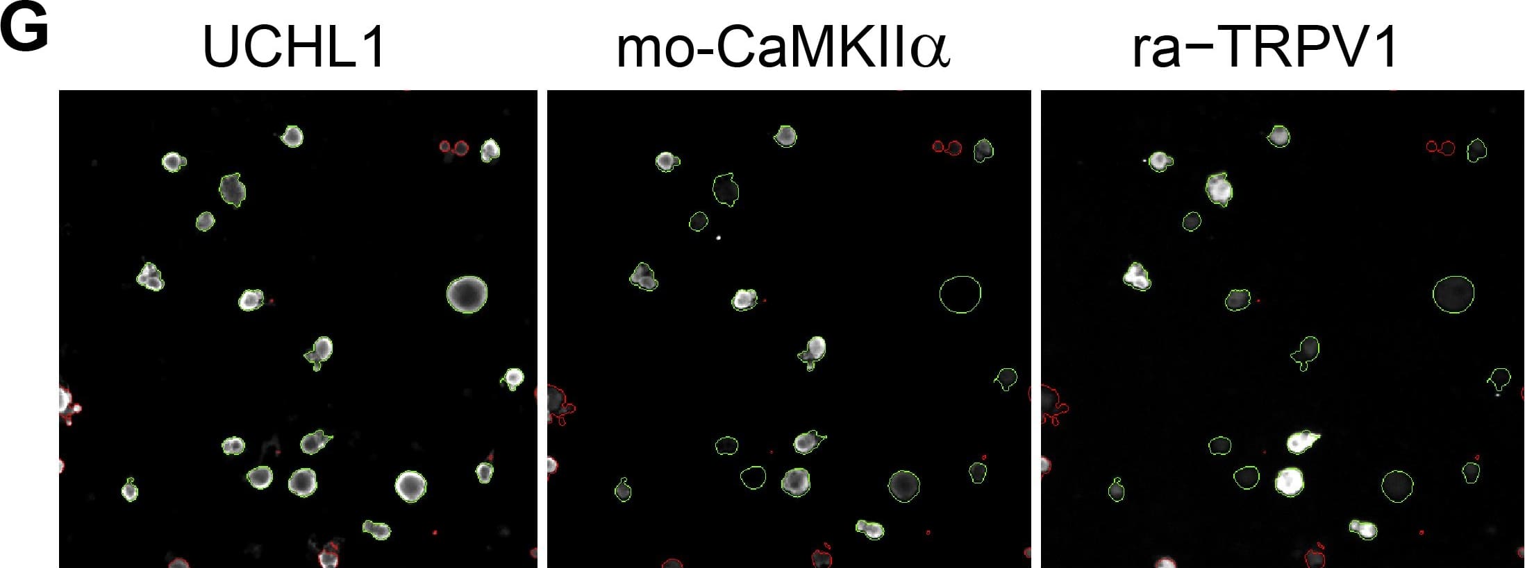 Immunocytochemistry/ Immunofluorescence: UCH-L1/PGP9.5 Antibody [NB110-58872] - Validation of the transcriptome data by single cell based quantitative High Content Screening (HCS) microscopy focusing on selected signaling-relevant proteins.(A) Triple staining of the neuronal marker UCHL1 & two different TRPV1 antibodies derived from rabbit & goat, respectively, to facilitate the analysis of various targets. The staining intensities obtained with both TRPV1 antibodies correlated significantly (Spearmans ρ = 0.96, p3000 analyzed neurons per experiment, paired two-tailed t-tests). Image collected & cropped by CiteAb from the following publication (//dx.plos.org/10.1371/journal.pone.0115731), licensed under a CC-BY license. Not internally tested by Novus Biologicals.