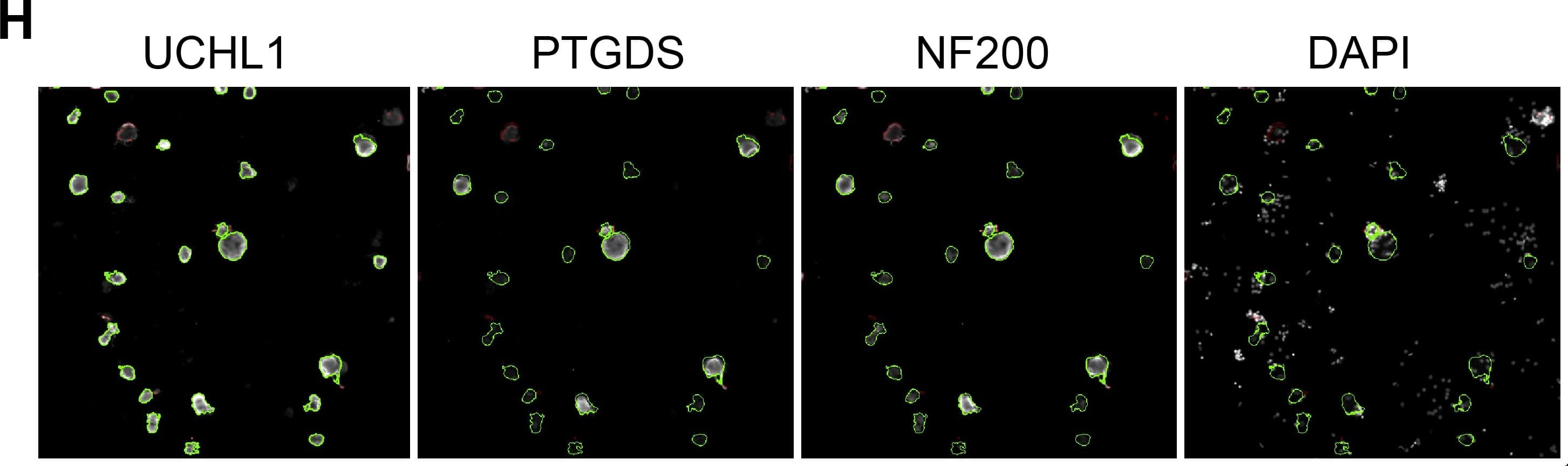 Immunocytochemistry/ Immunofluorescence: UCH-L1/PGP9.5 Antibody [NB110-58872] - PGD2 is a paracrine mediator synthesized in myelinated large-diameter neurons  acts on TRPV1(+) neurons.(A) Dose-dependent induction of RII phosphorylation in sensory neurons after 1 min stimulation w/ PGD2 (EC50 = 377 nM, n = 3,>2000 neurons/condition; one-way ANOVA w/ Bonferroni's multiple comparisons test). (B) PGD2 did not induce pRII in non-neuronal cells of same cultures shown in A. (C) Time course of RII phosphorylation indicating long-lasting effects of PGD2 (10 µM) on sensory neurons. (D) Stimulation w/ PGD2 also results in phosphorylation of ERK1/2 measured in same cultures shown in D. (E) Representative experiment demonstrating  induction of RII phosphorylation is enhanced in TRPV1(+) neurons (total of 3664 neurons). Plots of respective controls are shown in S2 Fig. (F) Fold changes of pRII intensities in TRPV1(−) (grey bars) & TRPV1(+) (black bars) neurons after 1 min stimulation w/ 10 µM PGD2 (n = 3,>2000 neurons/condition, one-way ANOVA w/ Bonferroni's multiple comparisons test). (G) Co-labeling of TRPV1 & PTGDS revealing  PTGDS is expressed in neurons lacking TRPV1 (total of 9951 neurons, also refer to S2 Fig. for control plots). (H) Co-labeling of NF200 & PTGDS showing  PTGDS(+) neurons express NF200 (total of 12966 neurons, also refer to S2 Fig. for control plots).(I) Size distribution of PTGDS(+) (green), NF200(+) (red), & all sensory neurons (black) indicating  PTGDS(+) neurons are larger than other neurons. (J) Suggested pathway of interneuronal communication between subgroups of sensory neurons. Large-diameter mechanosensitive neurons express PTGDS resulting in production of PGD2, which activates DP1 receptors present on nociceptive neurons expressing TRPV1. Image collected & cropped by CiteAb from following publication (//dx.plos.org/10.1371/journal.pone.0115731), licensed under a CC-BY license. Not internally tested by Novus Biologicals.