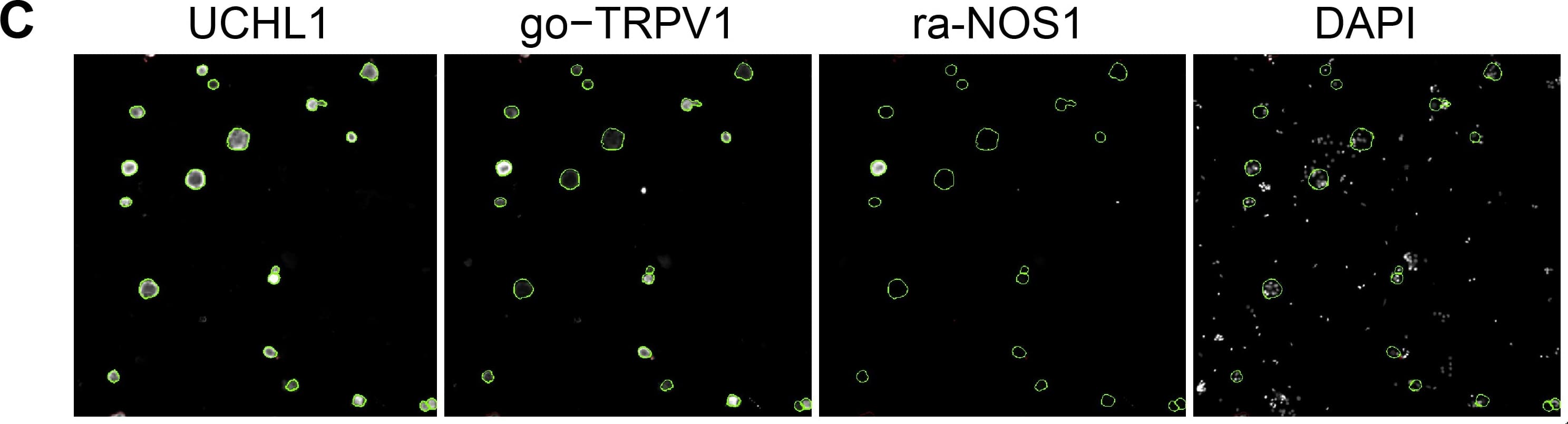 Immunocytochemistry/ Immunofluorescence: UCH-L1/PGP9.5 Antibody [NB110-58872] - Validation of the transcriptome data by single cell based quantitative High Content Screening (HCS) microscopy focusing on selected signaling-relevant proteins.(A) Triple staining of the neuronal marker UCHL1 & two different TRPV1 antibodies derived from rabbit & goat, respectively, to facilitate the analysis of various targets. The staining intensities obtained with both TRPV1 antibodies correlated significantly (Spearmans ρ = 0.96, p3000 analyzed neurons per experiment, paired two-tailed t-tests). Image collected & cropped by CiteAb from the following publication (//dx.plos.org/10.1371/journal.pone.0115731), licensed under a CC-BY license. Not internally tested by Novus Biologicals.