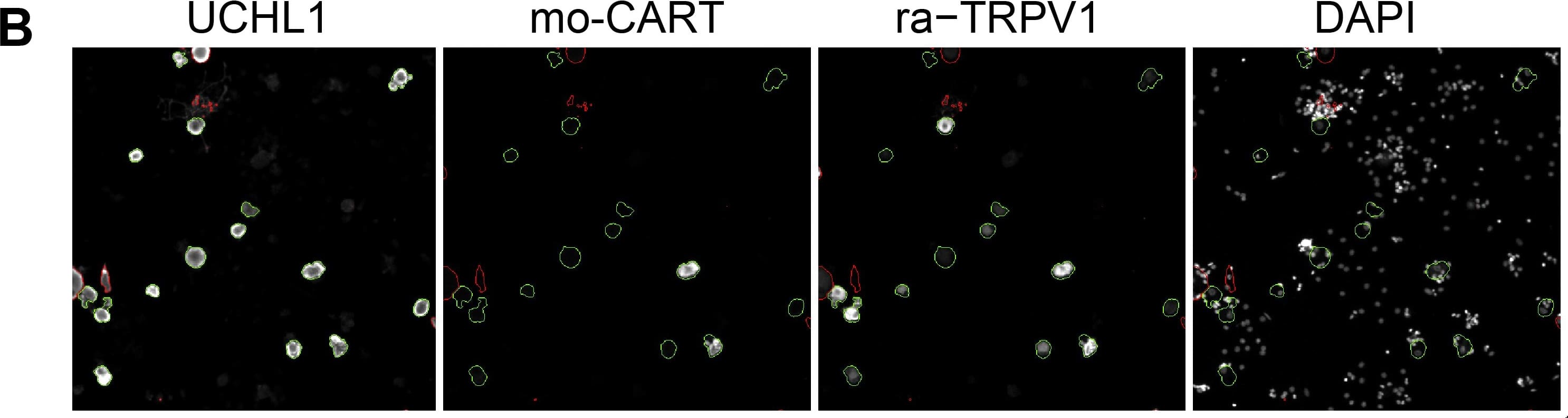 Immunocytochemistry/ Immunofluorescence: UCH-L1/PGP9.5 Antibody [NB110-58872] - Validation of the transcriptome data by single cell based quantitative High Content Screening (HCS) microscopy focusing on selected signaling-relevant proteins.(A) Triple staining of the neuronal marker UCHL1 & two different TRPV1 antibodies derived from rabbit & goat, respectively, to facilitate the analysis of various targets. The staining intensities obtained with both TRPV1 antibodies correlated significantly (Spearmans ρ = 0.96, p3000 analyzed neurons per experiment, paired two-tailed t-tests). Image collected & cropped by CiteAb from the following publication (//dx.plos.org/10.1371/journal.pone.0115731), licensed under a CC-BY license. Not internally tested by Novus Biologicals.