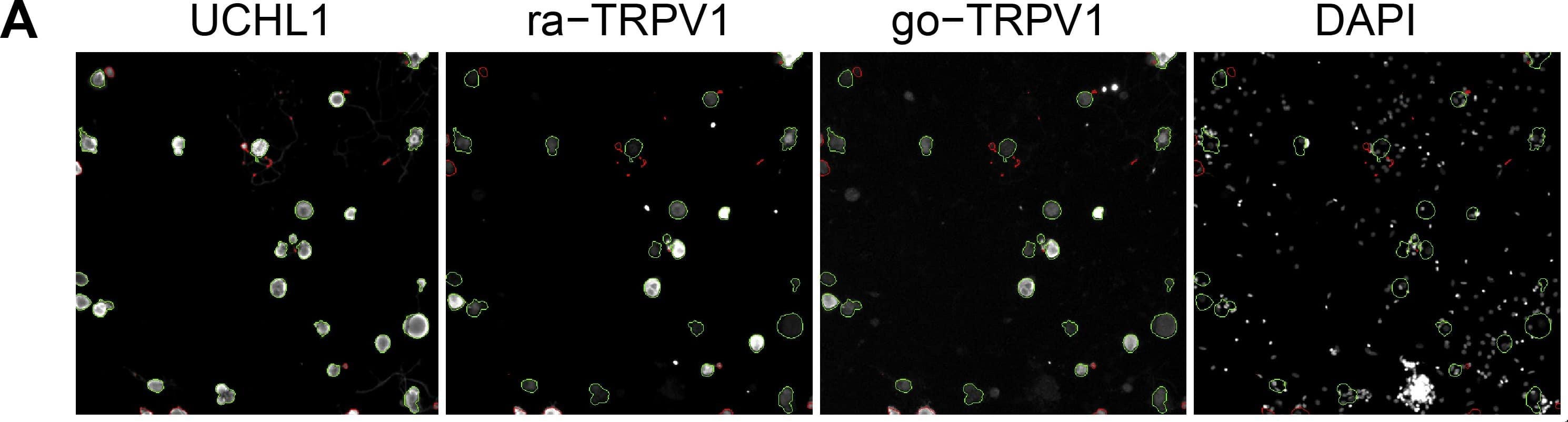 Immunocytochemistry/ Immunofluorescence: UCH-L1/PGP9.5 Antibody [NB110-58872] - Validation of the transcriptome data by single cell based quantitative High Content Screening (HCS) microscopy focusing on selected signaling-relevant proteins.(A) Triple staining of the neuronal marker UCHL1 & two different TRPV1 antibodies derived from rabbit & goat, respectively, to facilitate the analysis of various targets. The staining intensities obtained with both TRPV1 antibodies correlated significantly (Spearmans ρ = 0.96, p3000 analyzed neurons per experiment, paired two-tailed t-tests). Image collected & cropped by CiteAb from the following publication (//dx.plos.org/10.1371/journal.pone.0115731), licensed under a CC-BY license. Not internally tested by Novus Biologicals.