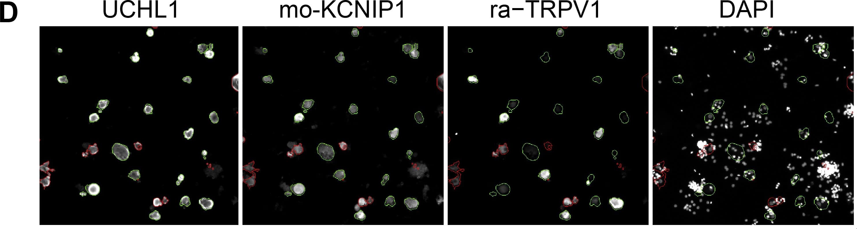 Immunocytochemistry/ Immunofluorescence: UCH-L1/PGP9.5 Antibody [NB110-58872] - Validation of the transcriptome data by single cell based quantitative High Content Screening (HCS) microscopy focusing on selected signaling-relevant proteins.(A) Triple staining of the neuronal marker UCHL1 & two different TRPV1 antibodies derived from rabbit & goat, respectively, to facilitate the analysis of various targets. The staining intensities obtained with both TRPV1 antibodies correlated significantly (Spearmans ρ = 0.96, p3000 analyzed neurons per experiment, paired two-tailed t-tests). Image collected & cropped by CiteAb from the following publication (//dx.plos.org/10.1371/journal.pone.0115731), licensed under a CC-BY license. Not internally tested by Novus Biologicals.