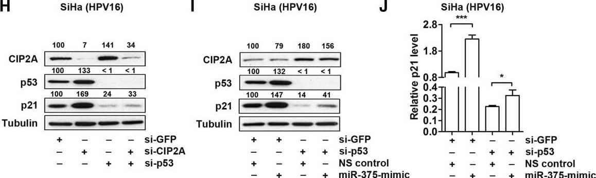 Western Blot: CIP2A Antibody (2G10) [NB110-59722] - miR-375 increases p21, p53, & RB in HPV16- & 18-positive cancer. (A) Protein levels of p21, p53, & RB in SiHa cells transfected w/ miR-375 inhibitor, -mimic, or NS control measured by Western blot analysis. 25%, 50%, 100% amounts of untreated cell lysates included to calibrate the semiquantitative measurement. (B) Relative endogenous mRNA levels of p21, p53, & RB measured in SiHa cells transfected w/ miR-375 inhibitor, -mimic, or NS control using qRT-PCR. (C) One hundred thousand SiHa cells seeded on 24-well plate & the number of cells counted by trypan blue exclusion staining assay 48 h post-transfection. (D) Protein levels of p21, p53, & RB in HeLa cells transfected w/ miR-375 inhibitor, -mimic, or NS control measured by Western blot analysis. (E) Relative p21 mRNA levels measured in HeLa cells transfected w/ miR-375 inhibitor, -mimic, or NS control. (F) Trypan blue exclusion staining assay used to analyze the proliferation rate of HeLa cells 48 h post-transcfection. (G) Flow cytometry analysis demonstrates G1 arrest of SiHa cells 48 h after transfection w/ miR-375-mimic compared to miR-375 inhibitor or NS control. (H) Protein levels of CIP2A, p53, & p21 in SiHa cells transfected w/ si-CIP2A and/or si-p53 measured by Western blot analysis. (I) Protein levels of CIP2A, p53, & p21 in SiHa cells transfected w/ si-p53 and/or miR-375-mimic measured by Western blot analysis. (J) mRNA levels of p21 in SiHa cells transfected w/ si-p53 and/or miR-375-mimic measured by qRT-PCR. The concentrations of siRNA or miRNA used in panels H, I, & J 10 nM & 25 nM, respectively. Results are expressed as mean ± SD from three independent experiments. *p < 0.05, ***p < 0.001, & ****p < 0.0001. Image collected & cropped by CiteAb from the following publication (//pubmed.ncbi.nlm.nih.gov/24708873), licensed under a CC-BY license. Not internally tested by Novus Biologicals.