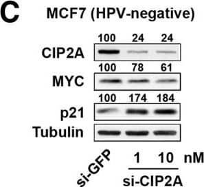 Western Blot: CIP2A Antibody (2G10) [NB110-59722] - miR-375 control on CIP2A-MYC pathway also contributes to p21 elevation. (A) p21, p53, RB, CIP2A, & MYC protein levels in MCF7 cells transfected with miR-375 inhibitor, -mimic, or NS control were measured by Western blot analysis. Tubulin expression was used as internal control. 25%, 50%, 100% amounts of untreated cell lysates were included to calibrate the semiquantitative measurement. (B) Transfection with miR-375-mimic significantly upregulated p21 mRNA in MCF7. Relative endogenous p21 mRNA levels were measured in MCF7 cells transfected with miR-375 inhibitor, -mimic, or NS control for 48 h using qRT-PCR. (C) CIP2A & MYC protein levels were effectively silenced by si-CIP2A transfection with 1 & 10 nM concentrations for 48 h. Increased p21 protein levels were detected in si-CIP2A dose-dependent manner. 10 nM of si-GFP was used as a control. (D) Protein levels of CIP2A, p53, & p21 in MCF7 cells transfected with si-p53 and/or miR-375-mimic were measured by Western blot analysis. (E) mRNA levels of p21 in MCF7 cells transfected with si-p53 and/or miR-375-mimic were measured by qRT-PCR. (F) Flow cytometry analysis demonstrates G1 arrest of MCF7 cells 48 h after transfection with miR-375-mimic compared to miR-375 inhibitor or NS control. The concentrations of siRNA or miRNA used in panels D, E, & F were 10 nM & 25 nM, respectively. (G) Schematic depiction of miR-375-mediated repression of CIP2A, E6, E6AP, & E7 in HPV16-positive cells that simultaneously increases tumor suppressor p53, p21, & RB, & causes cell cycle arrest. Results are expressed as mean ± SD from three independent experiments. *p < 0.05, **p < 0.01, & ***p < 0.001. Image collected & cropped by CiteAb from the following publication (//pubmed.ncbi.nlm.nih.gov/24708873), licensed under a CC-BY license. Not internally tested by Novus Biologicals.