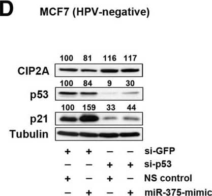 Western Blot: CIP2A Antibody (2G10) [NB110-59722] - miR-375 control on CIP2A-MYC pathway also contributes to p21 elevation. (A) p21, p53, RB, CIP2A, & MYC protein levels in MCF7 cells transfected with miR-375 inhibitor, -mimic, or NS control were measured by Western blot analysis. Tubulin expression was used as internal control. 25%, 50%, 100% amounts of untreated cell lysates were included to calibrate the semiquantitative measurement. (B) Transfection with miR-375-mimic significantly upregulated p21 mRNA in MCF7. Relative endogenous p21 mRNA levels were measured in MCF7 cells transfected with miR-375 inhibitor, -mimic, or NS control for 48 h using qRT-PCR. (C) CIP2A & MYC protein levels were effectively silenced by si-CIP2A transfection with 1 & 10 nM concentrations for 48 h. Increased p21 protein levels were detected in si-CIP2A dose-dependent manner. 10 nM of si-GFP was used as a control. (D) Protein levels of CIP2A, p53, & p21 in MCF7 cells transfected with si-p53 and/or miR-375-mimic were measured by Western blot analysis. (E) mRNA levels of p21 in MCF7 cells transfected with si-p53 and/or miR-375-mimic were measured by qRT-PCR. (F) Flow cytometry analysis demonstrates G1 arrest of MCF7 cells 48 h after transfection with miR-375-mimic compared to miR-375 inhibitor or NS control. The concentrations of siRNA or miRNA used in panels D, E, & F were 10 nM & 25 nM, respectively. (G) Schematic depiction of miR-375-mediated repression of CIP2A, E6, E6AP, & E7 in HPV16-positive cells that simultaneously increases tumor suppressor p53, p21, & RB, & causes cell cycle arrest. Results are expressed as mean ± SD from three independent experiments. *p < 0.05, **p < 0.01, & ***p < 0.001. Image collected & cropped by CiteAb from the following publication (//pubmed.ncbi.nlm.nih.gov/24708873), licensed under a CC-BY license. Not internally tested by Novus Biologicals.