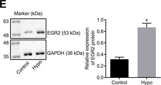 Overexpression of miR-10a-5p decreased cardiomyocyte apoptosis through inhibiting EGR2. (A) The target genes of miR-10a-5p predicted using Starbase, miRWalk, and RAID databases and the up-regulated genes in MI-related dataset GSE23294 and the potential binding sites of miR-10a-5p on EGR2. (B) The luciferase activity measured by dual-luciferase reporter gene assay. (C) Expression of EGR2 in myocardial tissues normalized to GAPDH determined by RT-qPCR (n = 10). (D) The expression pattern of EGR2 in hypoxic cardiomyocytes normalized to GAPDH determined by RT-qPCR. (E) The expression pattern of EGR2 in cardiomyocytes normalized to GAPDH determined by Western blot analysis. (F), Apoptosis of cardiomyocytes after EGR2 silencing determined by flow cytometry. (G) The expression patterns of EGR2, cleaved-caspase-3, Bax and Bcl-2 in cardiomyocytes after EGR2 silencing normalized to GAPDH determined by Western blot analysis. (H) The caspase-3 activity in hypoxic cardiomyocytes after EGR2 silencing. (I) The ATP content in hypoxic cardiomyocytes after EGR2 silencing. (J) The expression pattern of EGR2 in the hypoxic cardiomyocytes after alteration of EGR2 and/or miR-10a-5p normalized to GAPDH determined by RT-qPCR. (K) The caspase-3 activity in hypoxic cardiomyocytes after alteration of EGR2 and/or miR-10a-5p determined by RT-qPCR. (L) The ATP content in hypoxic cardiomyocytes after alteration of EGR2 and/or miR-10a-5p. * p < 0.05. The above data were all measurement data, and expressed as mean +/- standard deviation. The unpaired t test was adopted for comparison between two groups. One-way ANOVA was adopted for comparison among multiple groups with Tukey’s post hoc test. All data was generated from 3 independent experiments respectively. Image collected and cropped by CiteAb from the following open publication (//pubmed.ncbi.nlm.nih.gov/33819189), licensed under a CC-BY license. Not internally tested by Novus Biologicals.
