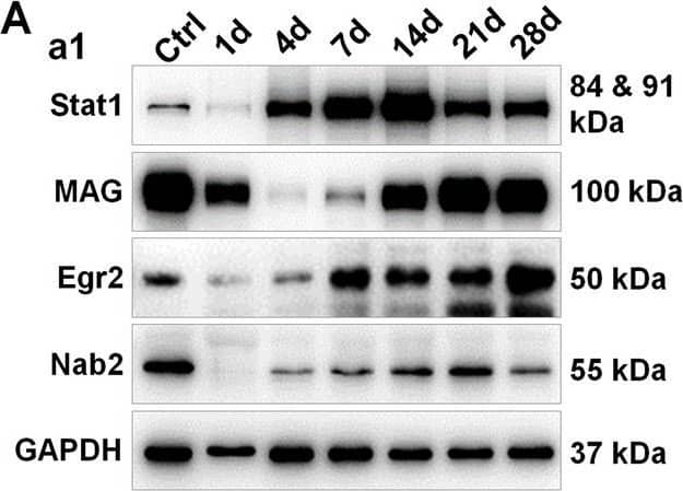 Expression changes and cellular localization of Stat1 after nerve injury. A (a1) Western blots showing the expression change of Stat1, MAG, Nab2 and Egr2 in nerve injury segment at the indicated time points following a nerve crush, with uninjured nerve used as the control (Ctrl). GAPDH served as the loading control. (a2–6) Histogram quantitatively compare the expression changes of Stat1, MAG, Nab2, and Egr2. ###p < 0.001, one-way ANOVA, *p < 0.05, **p < 0.01, ***p < 0.001 vs control, n = 3 ~ 4 per group. B Immunofluorescence staining of S100 beta  (a marker of SCs, red) and Stat1 (green) in injured sciatic nerve showing cellular localization of Stat1: on day 1 of injury, co-localization of Stat1 and S100 beta  was almost absent; on day 4 of injury, there was a small amount of Stat1 and S100 beta  co-localization; and from day 7 to day 28 of injury, Stat1 was mainly localized in SCs. Scale bars, 100 μm Image collected and cropped by CiteAb from the following open publication (//pubmed.ncbi.nlm.nih.gov/37365519), licensed under a CC-BY license. Not internally tested by Novus Biologicals.