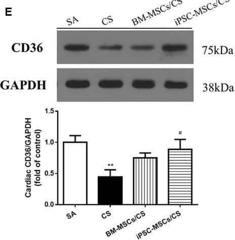 Effect of MSCs on cardiac expressions of proteins regulating cholesterol, triglycerides and FFA metabolism. (A) CS exposure caused significant elevation of cardiac expression of LDL-R, which was attenuated in both the BM-MSCs/CS and iPSC-MSCs/CS groups. (B) CS led to increased cardiac expression of HMGCR, which was attenuated in the iPSC-MSCs/CS group. (C) CS reduced cardiac expression of ABCA1, which was restored in the iPSC-MSCs/CS group. (D) CS exposure significantly reduced protein expression of LPL, which was restored in the iPSC-MSCs/CS group. (E) CS exposure led to a significant reduction in protein expression of cardiac CD36, which was significantly restored in the iPSC-MSCs/CS group. (F) Cardiac FAS protein expression was inhibited after CS exposure, which showed a trend of restoration but not reaching significant level in both the BM-MSCs/CS and iPSC-MSCs/CS groups. Cardiac levels of protein expression were normalized to GAPDH levels and expressed as fold change vs. relative control. Data are expressed as mean +/- SEM; n = 7–8. Data were analyzed by one-way ANOVA. ∗p < 0.05, ∗∗p < 0.01, ∗∗∗p < 0.001 for comparison between the CS and SA groups. #p < 0.05, ##p < 0.01 for comparison between the BM-MSCs/CS or iPSC-MSCs/CS groups and CS group, respectively. LDL-R, low density lipoprotein receptor; GAPDH, glyceraldehyde 3-phosphate dehydrogenase; HMGCR, 3-hydroxy-3-methylglutaryl coenzyme A reductase; ABCA1, ATP-binding cassette protein-A1; LPL, Lipoprotein lipase; CD36, fatty acid translocase (FAT)/CD36; FAS, fatty acid synthase. Image collected and cropped by CiteAb from the following open publication (//pubmed.ncbi.nlm.nih.gov/28804458), licensed under a CC-BY license. Not internally tested by Novus Biologicals.