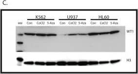 Western Blot: WT1 Antibody (6F-H2) - BSA Free [NB110-60011] - Hypomethylation of Intron 1 CpG island results in WT1 expression. (C) Cell lysates from K562, U937, & HL60 cells treated with CoCl2, 5-azacytidine, or untreated controls analyzed by WB using an antibody against WT1. Histone H3 used as a loading control. Size of molecular weight markers is in kDa. Image collected & cropped by CiteAb from the following publication (//dx.plos.org/10.1371/journal.pone.0119837), licensed under a CC-BY license. Not internally tested by Novus Biologicals.