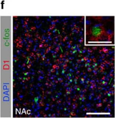 Immunocytochemistry/ Immunofluorescence: Dopamine D1R/DRD1 Antibody (SG2-D1a) [NB110-60017] - NAc D1 & D2 neuronal activation predicts performance in motivation-related tasks.(a) PIT outcome (n=10). (b) Breakpoint for two PR sessions (n=10). (c) Representative immunostaining of c-fos in the NAc; Scale bar: 100 μm; inset: 20 μm. (d) Animals performing PIT or PR tests have increased c-fos+ cells in the NAc (n=6). (e) Principal factor analysis was done to evaluate the contribution of each brain region for the behavioural performance. This analysis shows that the NAc core & shell regions (NAcc & NAcs; factor 2) are grouped distinctively from other limbic regions (BLA, CeA & VTA; factor 3) & from cortical regions that are all grouped together in factor 1 (ACC, PLC, ILC, lOFC & vOFC). Representative images of immunofluorescence for c-fos & dopamine receptor D1 (f) or c-fos & dopamine receptor D2 (i) in the NAc of animals that performed PR task; Scale bar: 100 μm; inset: 20 μm. Insets represent double positive cells. (g) Number of c-fos+/D1+ cells & c-fos+/D2+ (j) cells in the NAc (n=6). (h) Correlation between individual Breakpoint & number of c-fos+/D1+ cells in the NAc (n=9). (k) Correlation between individual breakpoint & number of c-fos+/D2+ cells in the NAc (n=12). Error bars denote s.e.m. *P≤0.05, **P ≤0.01, ***P≤0.001. Image collected & cropped by CiteAb from the following publication (//www.nature.com/articles/ncomms11829), licensed under a CC-BY license. Not internally tested by Novus Biologicals.