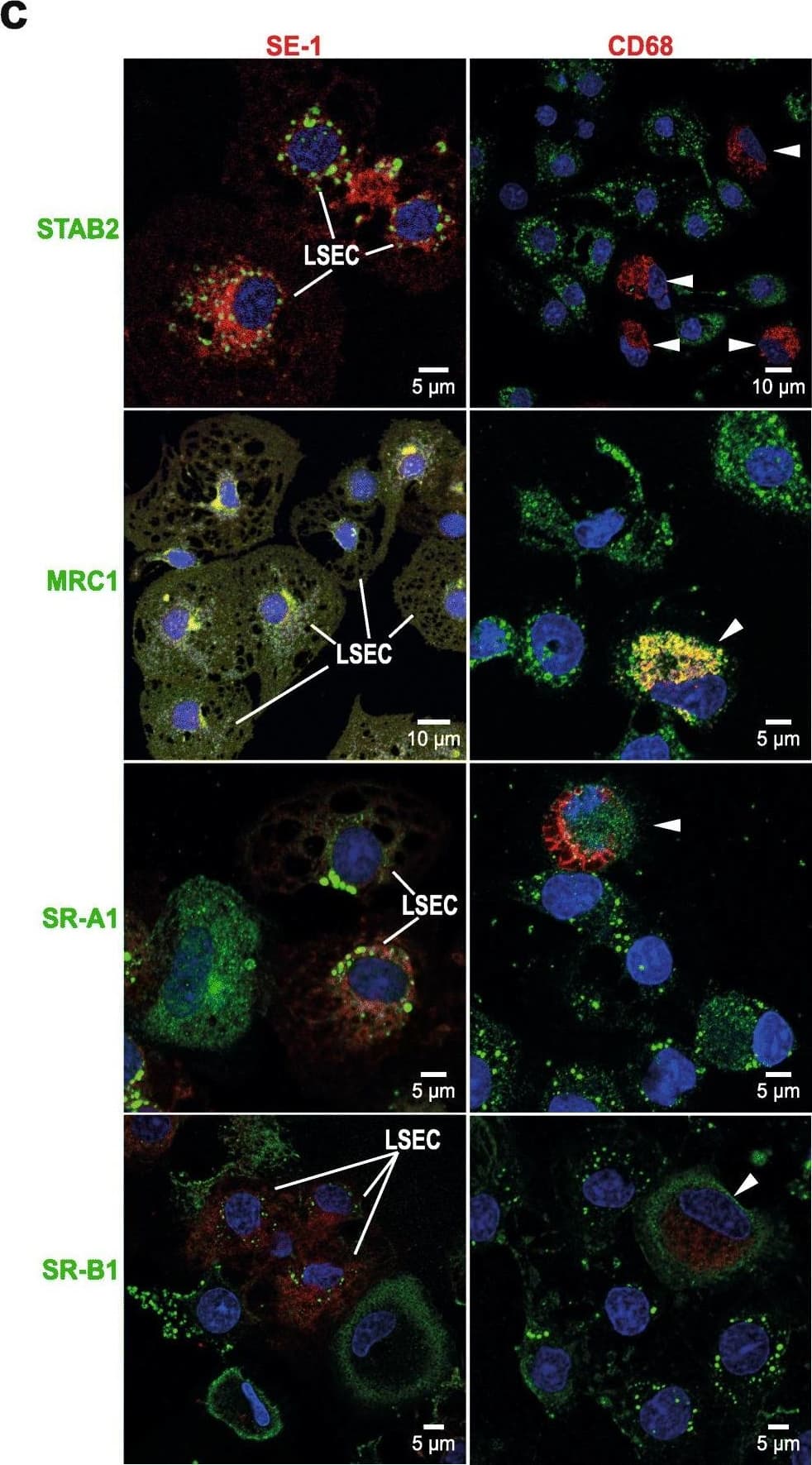 Expression of scavenger receptors and immune lectins in rat LSECs and KCs. a. Unscaled heatmaps of normalized log2 expression values (log2 (RPKM+ 1), and log2 (iBAQ+ 1)) for scavenger receptors (SR) and C-type lectins in the KC and LSEC transcriptomes and proteomes. Underlined: Genes expressed in the transcriptome that were also present in the proteome. b. Absolute abundance of selected SR gene products in the KC and LSEC transcriptomes and proteomes. The bar height reflects good correlation between the transcriptome and proteome data for gene products of Clec4g, Clec4m, Stab1, and Stab2 in both cell types. The abundance of gene products of Marco and Cd5l were well correlated between the KC transcriptome and proteome, while LSECs showed high abundance of these gene products only at mRNA level. c. Immune labeling of non-parenchymal liver cell (NPC) cultures for selected SRs and C-type lectins. NPCs from the 25–45% interface on the Percoll gradient were incubated for 1 h, then fixed 15 min in 4% paraformaldehyde, and double immune-labeled with antibodies to Fc gamma RIIb2 (SE-1; red fluorescence; left column), or CD68 (red fluorescence; right column), and to either stabilin-2 (STAB2; green), mannose receptor (MRC1; green), SR-A1 (green), or SR-B1 (green). Overlap of green and red fluorescence is seen as yellow staining in the overlay images. Antibodies are listed in Table 1. Cell nuclei were stained with DAPI (blue). Arrow heads point to CD68 positive KCs. Antibodies to stabilin-2 and Fc gamma RIIb2 (SE-1) specifically labeled LSECs and the CD68-antibody specifically labeled KCs, whereas positive labeling for the mannose receptor, SR-A1, and SR-B1 was observed in both LSECs and KCs Image collected and cropped by CiteAb from the following open publication (//pubmed.ncbi.nlm.nih.gov/33246411), licensed under a CC-BY license. Not internally tested by Novus Biologicals.