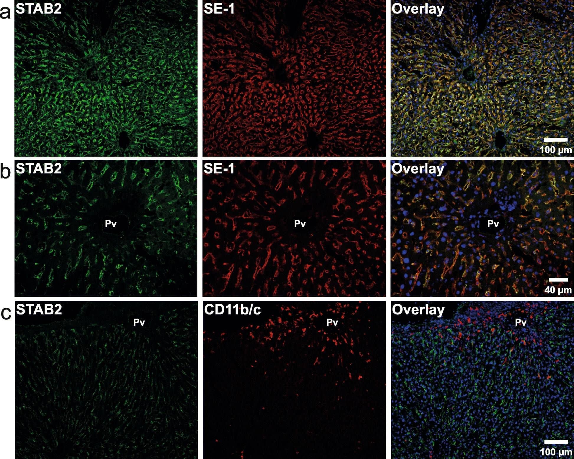 Immunocytochemistry/ Immunofluorescence: Hepatic Sinusoidal Endothelial Cells Antibody (SE-1) [Alexa Fluor® 488] [NB110-68095AF488] - Immune histochemistry of acetone-fixed frozen rat liver sections. The sections were double immune-labeled with primary antibodies against a-b) stabilin-2 (STAB2; green fluorescence), & Fc gamma RIIb2 (SE-1; red fluorescence), or against c) stabilin-2 (STAB2; green fluorescence), & CD11b/c (red fluorescence). Antibodies are listed in Table 1. Pv, portal vein. Nuclei were stained with DAPI (blue fluorescence in overlay images) Image collected & cropped by CiteAb from the following publication (//pubmed.ncbi.nlm.nih.gov/33246411), licensed under a CC-BY license. Not internally tested by Novus Biologicals.