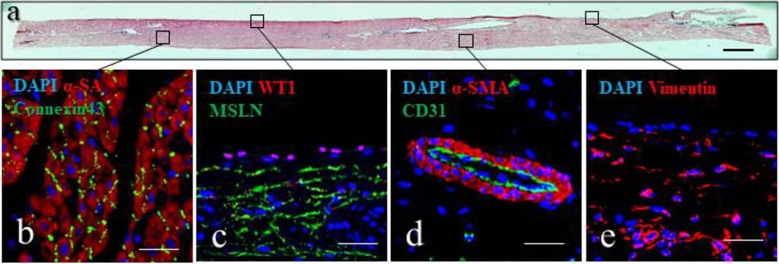 Epicardial slices structure analysis. (a) Tissue architecture evaluation of epicardial slices performed using hematoxylin and eosin coloration. Scale bar, 500 μm. (b–e) Immunohistochemical staining and confocal microscopy of epicardial slices. (b) Cardiomyocytes are stained with  alpha -sarcomeric actin and the intercalated disk is stained with connexin-43 antibody. (c) Epicardial cells highlighted with WT1 and mesenchymal derived cells stained with MSLN. (d) Microvasculature is stained with  alpha - smooth muscle actin and the endothelial marker CD31. (e) Mesenchymal cells are stained with vimentin. Nuclei are labeled with DAPI. Scale bars, 50 μm. Image collected and cropped by CiteAb from the following open publication (//pubmed.ncbi.nlm.nih.gov/35924218), licensed under a CC-BY license. Not internally tested by Novus Biologicals.