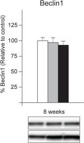 Western Blot: Beclin 1 Antibody - BSA Free [NB110-87318] - Maintenance of basal levels of autophagy in mice overexpressing htt fragments in the hypothalamus.The expression levels of selected autophagy markers were analyzed by Western blot in mice bilaterally injected with rAAV5-htt853-18Q or rAAV5-htt853-79Q & compared to uninjected controls 8 weeks post injection (n = 6–7/group). The data displayed maintenance of the autophagy flux, despite the presence of a clear metabolic phenotype in the injected mice. The data in the graphs are expressed as mean ± SEM relative to the uninjected controls. The Western blots are representative of one sample for each group. Image collected & cropped by CiteAb from the following publication (//dx.plos.org/10.1371/journal.pone.0083050), licensed under a CC-BY license. Not internally tested by Novus Biologicals.