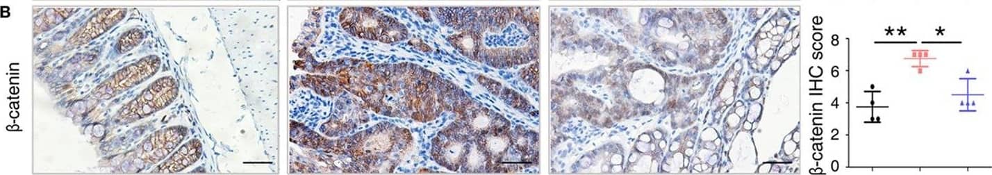 Immunohistochemistry: S100A9 Antibody [NB110-89726] - Key molecules of specific signaling pathways are assayed by immunohistochemistry in the colorectum of mice. Immunohistochemistry (200× magnification) of (A) S100a9, (B)  beta -catenin, (C) c-Myc, (D) p-Akt, (E) p-Smad2, & (F) Cxcl5 in normal control, IgG Ab, & anti-S100a9 Ab-treated colorectal tissues of the colitis-associated cancer mouse (n = 4). Scale bar, 50 µm. Staining scores were determined by semi-quantitative optical analysis. Image collected & cropped by CiteAb from the following publication (//pubmed.ncbi.nlm.nih.gov/29326691), licensed under a CC-BY license. Not internally tested by Novus Biologicals.