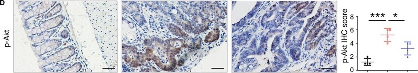 Immunohistochemistry: S100A9 Antibody [NB110-89726] - Key molecules of specific signaling pathways are assayed by immunohistochemistry in the colorectum of mice. Immunohistochemistry (200× magnification) of (A) S100a9, (B)  beta -catenin, (C) c-Myc, (D) p-Akt, (E) p-Smad2, & (F) Cxcl5 in normal control, IgG Ab, & anti-S100a9 Ab-treated colorectal tissues of the colitis-associated cancer mouse (n = 4). Scale bar, 50 µm. Staining scores were determined by semi-quantitative optical analysis. Image collected & cropped by CiteAb from the following publication (//pubmed.ncbi.nlm.nih.gov/29326691), licensed under a CC-BY license. Not internally tested by Novus Biologicals.