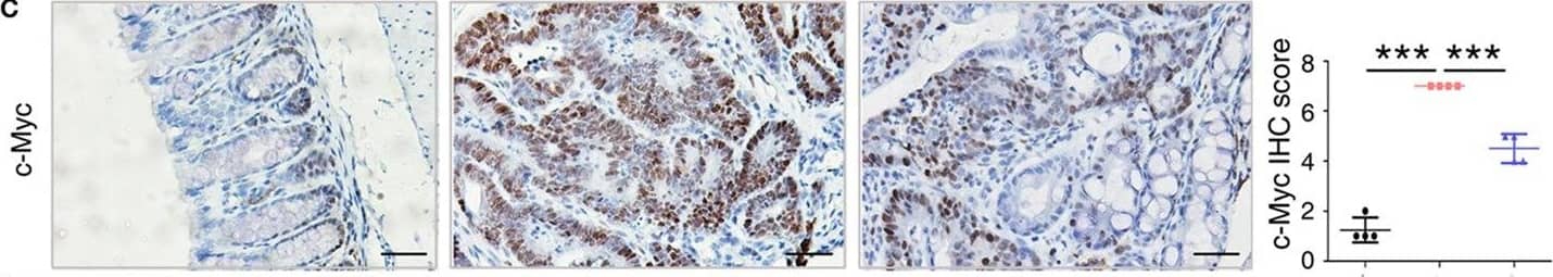 Immunohistochemistry: S100A9 Antibody [NB110-89726] - Key molecules of specific signaling pathways are assayed by immunohistochemistry in the colorectum of mice. Immunohistochemistry (200× magnification) of (A) S100a9, (B)  beta -catenin, (C) c-Myc, (D) p-Akt, (E) p-Smad2, & (F) Cxcl5 in normal control, IgG Ab, & anti-S100a9 Ab-treated colorectal tissues of the colitis-associated cancer mouse (n = 4). Scale bar, 50 µm. Staining scores were determined by semi-quantitative optical analysis. Image collected & cropped by CiteAb from the following publication (//pubmed.ncbi.nlm.nih.gov/29326691), licensed under a CC-BY license. Not internally tested by Novus Biologicals.