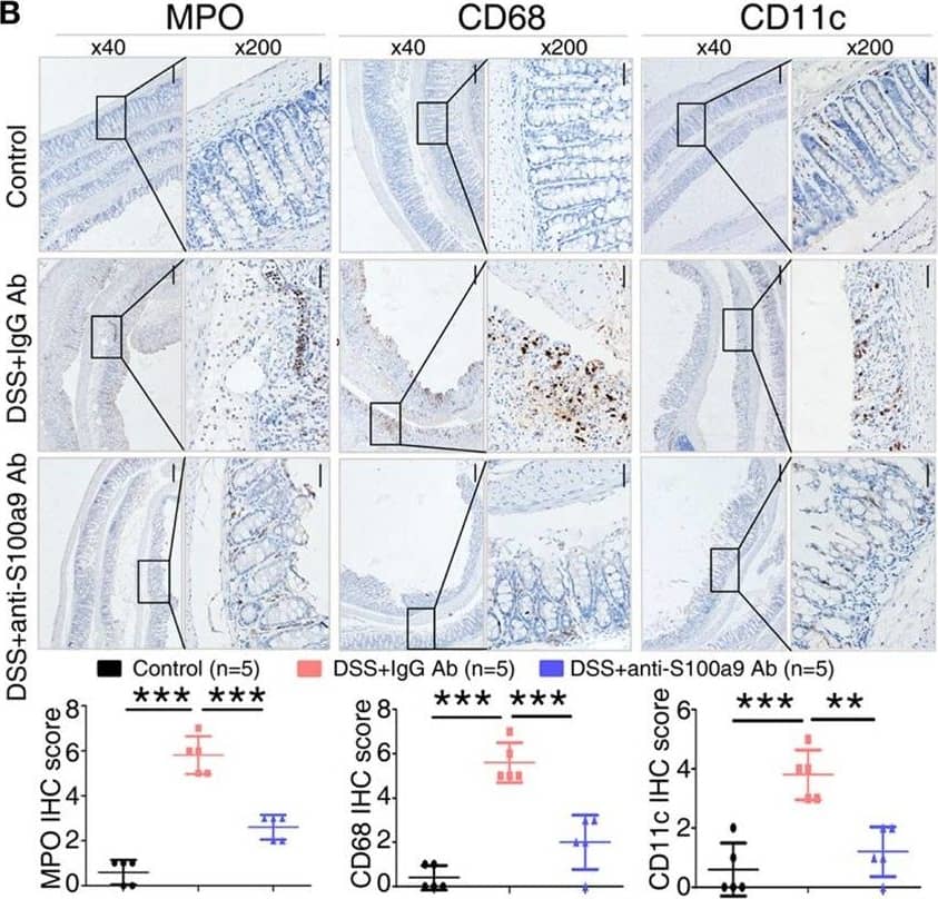 Immunohistochemistry: S100A9 Antibody [NB110-89726] - Effects of anti-S100a9 Ab on the frequency of neutrophils, macrophages, & dendritic cells (DCs) in the colon of the dextran sulfate sodium (DSS) mouse model. (A) Colon lamina propria cells were isolated from normal control & IgG Ab or anti-S100a9 Ab-treated DSS mice at day 6 post-DSS colitis induction. Frequencies of neutrophils, macrophages, & DCs in the colon were determined by flow cytometry. Cells were gated on CD45+CD3−CD4−CD11b+Ly6G+, CD45+CD3−CD4−CD11b+F4/80+, & CD45+CD3−CD4−CD11b+CD11c+ populations respectively. Representative flow cytometric figures were shown. The percentage of cells was presented as the mean ± SEM of four to six individual mice per group. *p < 0.05 in a one-way analysis of variance followed by Bonferroni correction. Data were representative of three independent experiments. (B) Immunohistochemical staining of myeloperoxidase (MPO), CD68, & CD11c proteins in the normal control & IgG Ab or anti-S100a9 Ab-treated colitis mice at day 6 (left panels: original magnification 40×, scale bar: 200 µm; right panels: original magnification 200×, scale bar: 50 µm). Staining scores were counted. One-way analysis of variance followed by Bonferroni correction. Results were representative of the three experiments performed. Error bars represent SD. (C) Expression of S100a9, Tnf alpha , Il1 beta , Il6, Il17a, Ifn gamma , Il12a, Il23a, Il4, & Il10 mRNA, as assessed by quantitative real-time PCR in normal control & IgG Ab, or anti-S100a9 Ab-treated colitis tissues. Image collected & cropped by CiteAb from the following publication (//pubmed.ncbi.nlm.nih.gov/29326691), licensed under a CC-BY license. Not internally tested by Novus Biologicals.