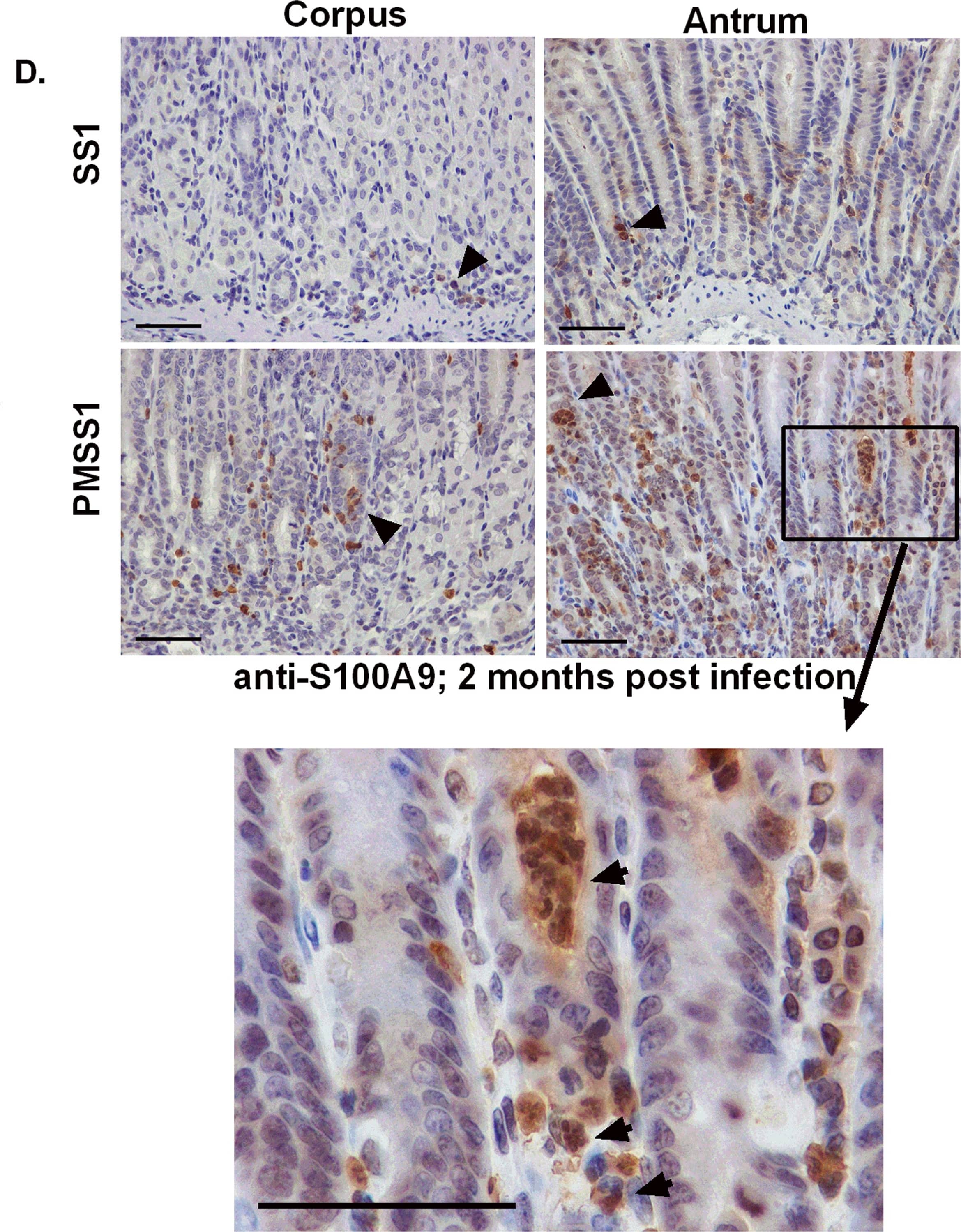 Immunohistochemistry: S100A9 Antibody [NB110-89726] - Host CP (S100A8/A9) is elevated in H. pylori infected stomach tissue.A) s100a8/s100a9 transcript abundance in RNA extracted from C57BL/6 mice infected with H. pylori PMSS1 or SS1 for 1, 2, or 3 months relative to uninfected animals as determined by real-time RT-PCR analysis. Points indicate mean relative units of transcript abundance +/− SEM (levels of s100a8 in PMSS1-infected mice compared to uninfected mice; 1 mo p = 0.0511; 2 mo p = 0.0432; 3 mo p = 0.0127; levels of s100a8 in SS1-infected mice compared to uninfected mice at 2 mo p = 0.0623 Student's t test). (B) Inflammation scores of H. pylori infected mice at 1, 2, & 3 months post infection. (C) s100a8/s100a9 transcript abundance in RNA extracted from gastric biopsies derived from human patients, which were either H. pylori-positive or H. pylori-negative (s100a8 p = 0.15; s100a9 *p = 0.05). Bars indicate mean relative units of transcript abundance +/− SEM. Each experimental group represents≥5 individuals (mice or human samples). D) Gastric samples derived from H. pylori PMSS1-infected WT mice or SS1-infected WT mice at 2 months post-infection were analyzed via immunohistochemistry using a polyclonal antibody to S100A9 (scale bars are 50 microns). E) Real-time RT-PCR was performed on gastric tissue to quantify s100a8 & s100a9 transcript abundance from WT (C57BL/6 mice) & IL-17RA-/- mice infected with PMSS1. Data represent relative units of transcript abundance +/− SEM in WT mice & IL-17RA-/- mice, *p = 0.0169 & p = 0.0143, respectively. Image collected & cropped by CiteAb from the following publication (//pubmed.ncbi.nlm.nih.gov/25330071), licensed under a CC0-1.0 license. Not internally tested by Novus Biologicals.