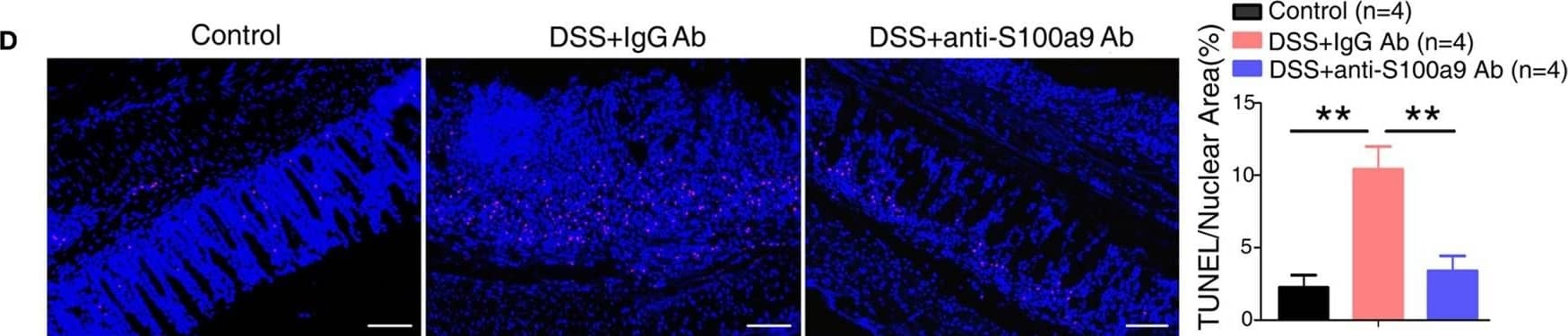 Immunohistochemistry: S100A9 Antibody [NB110-89726] - Anti-S100a9 Ab ameliorates inflammatory response of dextran sulfate sodium (DSS)-induced colitis in mice. (A) 6 days after DSS treatment, representative H&E-stained colon sections were shown (upper panels: original magnification 40×, scale bar: 200 µm; lower panels: original magnification 100×, scale bar: 100 µm). (B) Colon inflammation, ulceration, & crypt damage were scored individually, & composite total score was scored. n = 5 per group. (C) Isolated lymphoid follicles (ILFs) area was measured at day 6. Representative TUNEL staining (D) & ethynyl-2′-deoxyuridine (EdU) staining (E) of normal mice & DSS-induced mice, which were treated with IgG Ab or anti-S100a9 Ab on day 6. The percent of positive cells was measured. At least six fields were counted per mouse. Scale bar, 100 µm. Image collected & cropped by CiteAb from the following publication (//pubmed.ncbi.nlm.nih.gov/29326691), licensed under a CC-BY license. Not internally tested by Novus Biologicals.