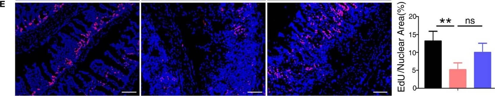 Immunohistochemistry: S100A9 Antibody [NB110-89726] - Anti-S100a9 Ab ameliorates inflammatory response of dextran sulfate sodium (DSS)-induced colitis in mice. (A) 6 days after DSS treatment, representative H&E-stained colon sections were shown (upper panels: original magnification 40×, scale bar: 200 µm; lower panels: original magnification 100×, scale bar: 100 µm). (B) Colon inflammation, ulceration, & crypt damage were scored individually, & composite total score was scored. n = 5 per group. (C) Isolated lymphoid follicles (ILFs) area was measured at day 6. Representative TUNEL staining (D) & ethynyl-2′-deoxyuridine (EdU) staining (E) of normal mice & DSS-induced mice, which were treated with IgG Ab or anti-S100a9 Ab on day 6. The percent of positive cells was measured. At least six fields were counted per mouse. Scale bar, 100 µm. Image collected & cropped by CiteAb from the following publication (//pubmed.ncbi.nlm.nih.gov/29326691), licensed under a CC-BY license. Not internally tested by Novus Biologicals.