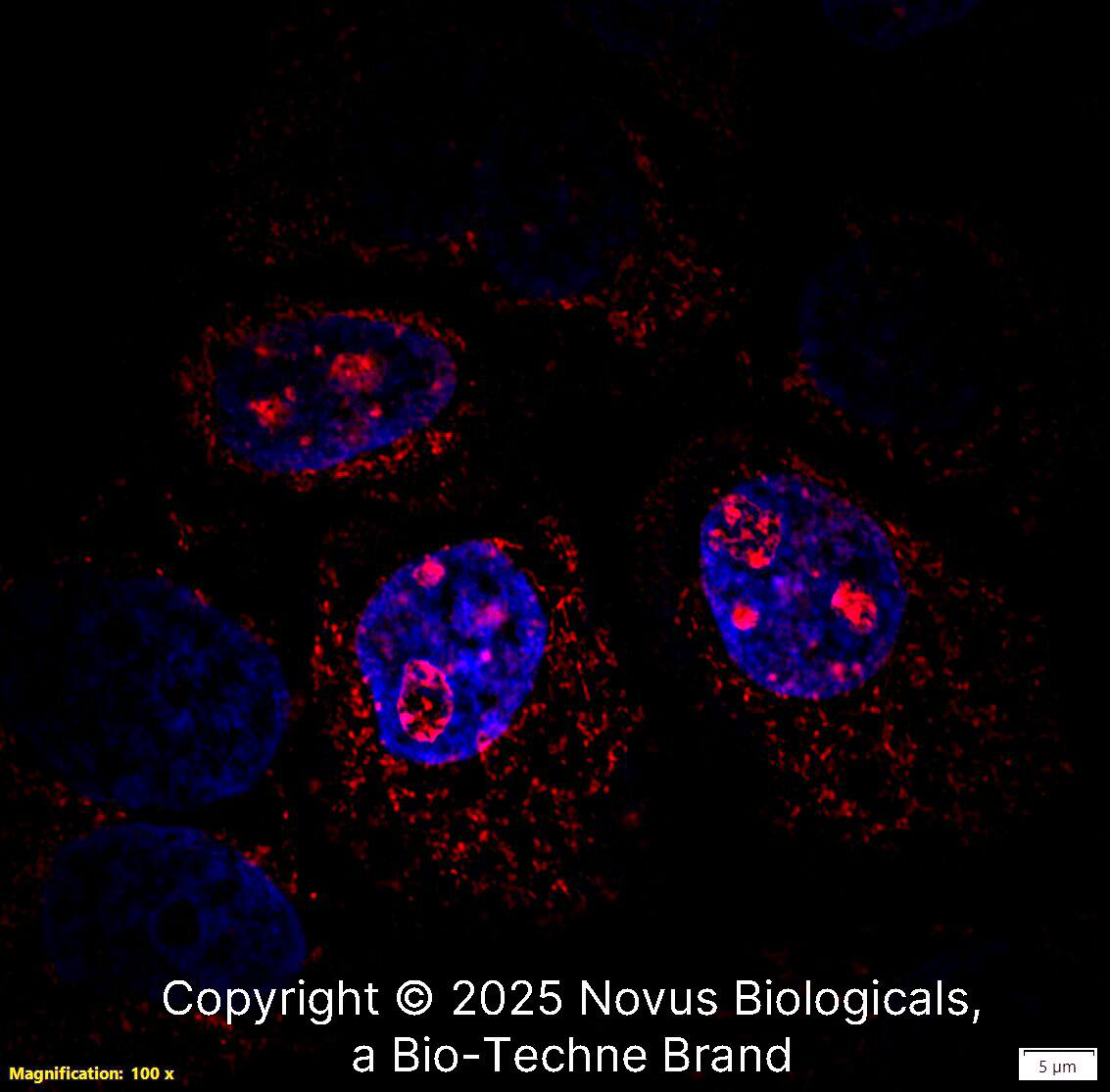 Ki67/MKI67 was detected in immersion fixed A431 human skin carcinoma cell line using Rabbit anti-Ki67/MKI67 Affinity Purified Polyclonal Antibody conjugated to Biotin (Catalog # NB110-90592B) at 2 µg/mL overnight at 4C. Cells were stained using Streptavidin conjugated to DyLight 550 (red) and counterstained with DAPI (blue). Cells were imaged using a 100X objective and digitally deconvolved.
