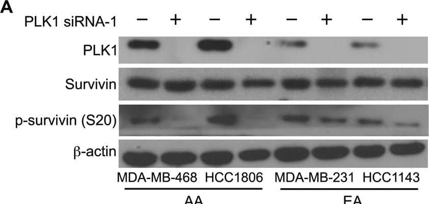 Silencing or inhibition of PLK1 and AURKB modulates survivin phosphorylation at S20 and T117 in AA TNBC cells.A, B Immunoblots showing the levels of PLK1, survivin, p-survivin (S20), and  beta -actin after PLK1 silencing (A, B) or inhibition (C) in AA and EA TNBC cell lines. D–F Immunoblots showing the levels of AURKB, survivin, p-survivin (T117), and  beta -actin after AURKB silencing (D, E), or inhibition (F) in AA and EA TNBC cell lines. Image collected and cropped by CiteAb from the following open publication (//pubmed.ncbi.nlm.nih.gov/36627281), licensed under a CC-BY license. Not internally tested by Novus Biologicals.