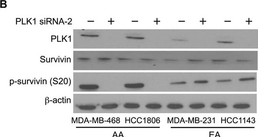 Silencing or inhibition of PLK1 and AURKB modulates survivin phosphorylation at S20 and T117 in AA TNBC cells.A, B Immunoblots showing the levels of PLK1, survivin, p-survivin (S20), and  beta -actin after PLK1 silencing (A, B) or inhibition (C) in AA and EA TNBC cell lines. D–F Immunoblots showing the levels of AURKB, survivin, p-survivin (T117), and  beta -actin after AURKB silencing (D, E), or inhibition (F) in AA and EA TNBC cell lines. Image collected and cropped by CiteAb from the following open publication (//pubmed.ncbi.nlm.nih.gov/36627281), licensed under a CC-BY license. Not internally tested by Novus Biologicals.