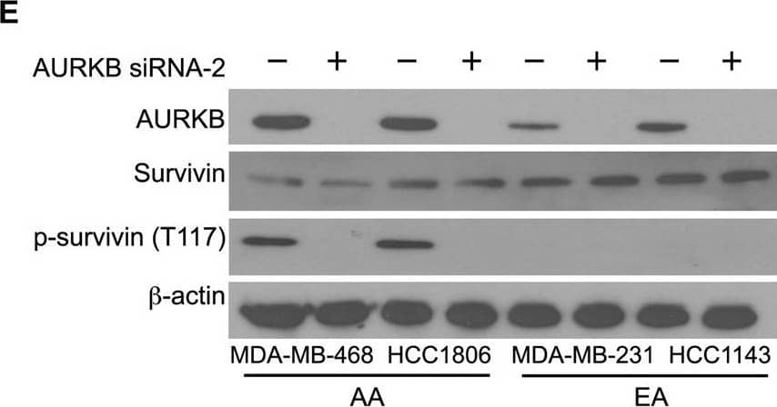 Silencing or inhibition of PLK1 and AURKB modulates survivin phosphorylation at S20 and T117 in AA TNBC cells.A, B Immunoblots showing the levels of PLK1, survivin, p-survivin (S20), and  beta -actin after PLK1 silencing (A, B) or inhibition (C) in AA and EA TNBC cell lines. D–F Immunoblots showing the levels of AURKB, survivin, p-survivin (T117), and  beta -actin after AURKB silencing (D, E), or inhibition (F) in AA and EA TNBC cell lines. Image collected and cropped by CiteAb from the following open publication (//pubmed.ncbi.nlm.nih.gov/36627281), licensed under a CC-BY license. Not internally tested by Novus Biologicals.