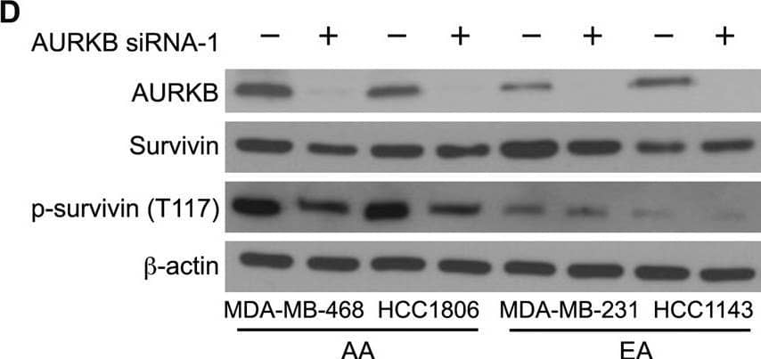 Silencing or inhibition of PLK1 and AURKB modulates survivin phosphorylation at S20 and T117 in AA TNBC cells.A, B Immunoblots showing the levels of PLK1, survivin, p-survivin (S20), and  beta -actin after PLK1 silencing (A, B) or inhibition (C) in AA and EA TNBC cell lines. D–F Immunoblots showing the levels of AURKB, survivin, p-survivin (T117), and  beta -actin after AURKB silencing (D, E), or inhibition (F) in AA and EA TNBC cell lines. Image collected and cropped by CiteAb from the following open publication (//pubmed.ncbi.nlm.nih.gov/36627281), licensed under a CC-BY license. Not internally tested by Novus Biologicals.