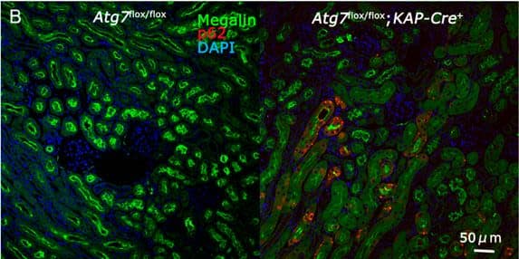 Immunocytochemistry/ Immunofluorescence: LRP2 Antibody (CD7D5) - Azide and BSA Free [NB110-96417] - Impairment of autophagy in Atg7-deficient renal proximal tubular cells. (A) Decrease of Atg7 & increase of LC3-I in 2-month-old Atg7flox/flox;KAP-Cre+ mouse kidney. Atg7 & LC3 Western blot (LC3-I/unconjugated LC3 & LC3-II/lipidated LC3) using whole kidney lysate of Atg7flox/flox;KAP-Cre+ mice. As a control, Atg7flox/flox mouse kidney was employed. The intensity of each band of Atg7 &  beta -actin was estimated by densitometry. The ratio of Atg7 to  beta -actin was calculated. The amount of Atg7-positive signals in the Atg7flox/flox;KAP-Cre+ mice kidney was about 63% lower than that in the Atg7flox/flox mice kidney (n = 3). Note that LC3-I was increased in the Atg7flox/flox;KAP-Cre+ mouse kidney. (B) The massive accumulation of p62 in kidneys of 2-month old Atg7flox/flox;KAP-Cre+ mouse. The cortico-medullary region of each kidney in 2 month-old Atg7flox/flox;KAP-Cre+ mouse & Atg7flox/flox mouse was recognized with anti-p62 antibody (red). As a marker of renal proximal tubular cells, megalin (green) was employed. Nuclei were stained with 4′,6-diamidino-2-phenylindole (DAPI; blue). (C) Quantification of p62 positive area of 2-month-old Atg7flox/flox;KAP-Cre+ (n = 5) & Atg7flox/flox kidney (n = 4, *** p < 0.01). Data in graphs are expressed as the mean ± SEM. Statistical analyses were performed using a student’s t-test. (D) Age-dependent accumulation of p62 (red) in the Atg7flox/flox;KAP-Cre+ mouse kidney in 1-, 2-, 6-, & 9-month-old Atg7flox/flox;KAP-Cre+ (lower) & Atg7flox/flox (upper) mouse kidney. Image collected & cropped by CiteAb from the following publication (//pubmed.ncbi.nlm.nih.gov/31881660), licensed under a CC-BY license. Not internally tested by Novus Biologicals.